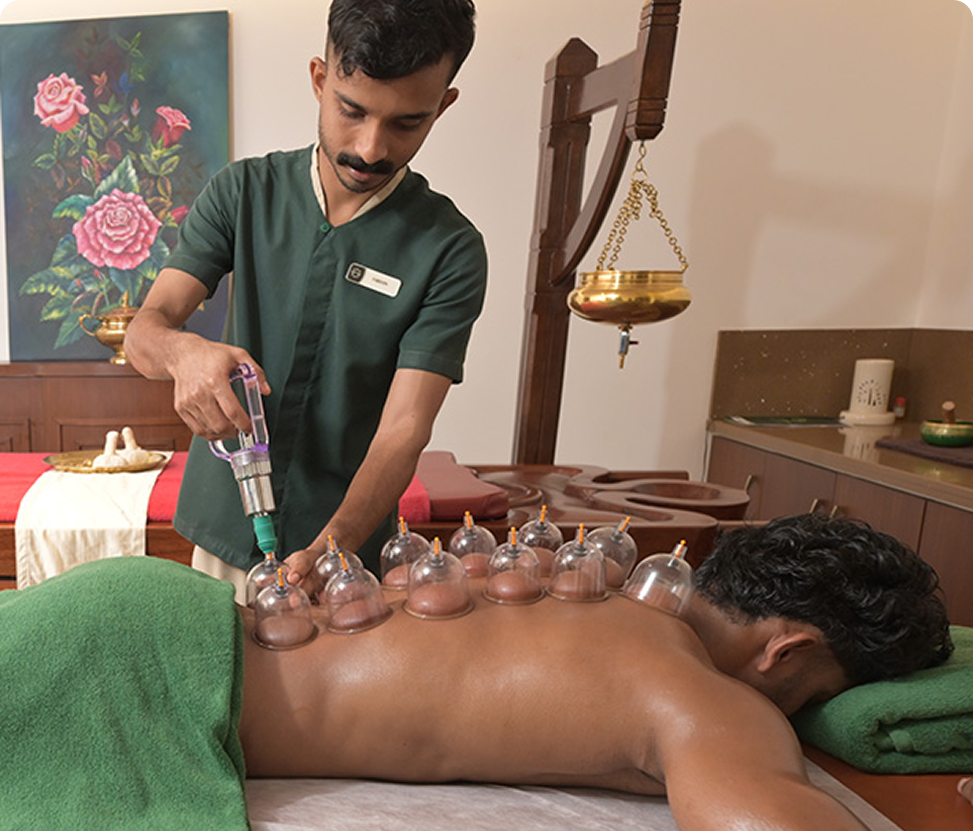 Hijama (cupping therapy) treatment showing traditional wet cupping procedure used for detoxification, pain relief, and improving blood circulation through therapeutic suction on the skin.